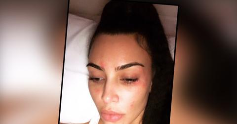Kim Kardashian Morning Psoriasis Candid Selfie