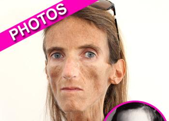 //thinnest woman landov