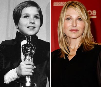 //tatum oneal child actor plastic surgery