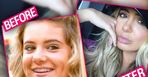 Brielle Biermann Nose Job Plastic Surgery RHOA