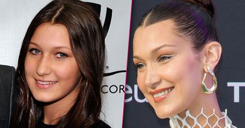 Bella Hadid – Supermodel’s Denial Of Plastic Surgery May Be A Lie