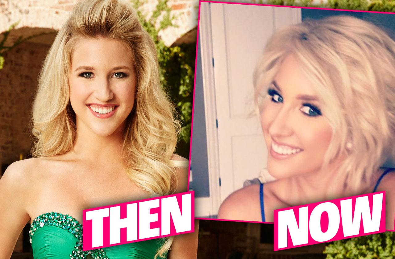 Todd Chrisley Teen Daughter Savannahs Plastic Surgery Exposed By Top Docs