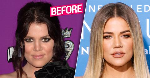 //khloe kardashian too far cosmetic surgery obsession pp