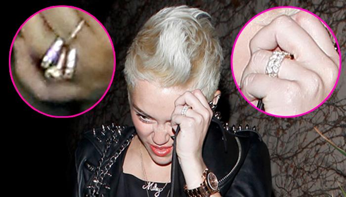 //miley ring before after x