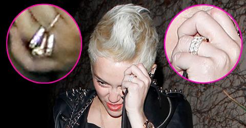 //miley ring before after x