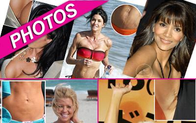 //celeb surgical scars wennsplpcn post