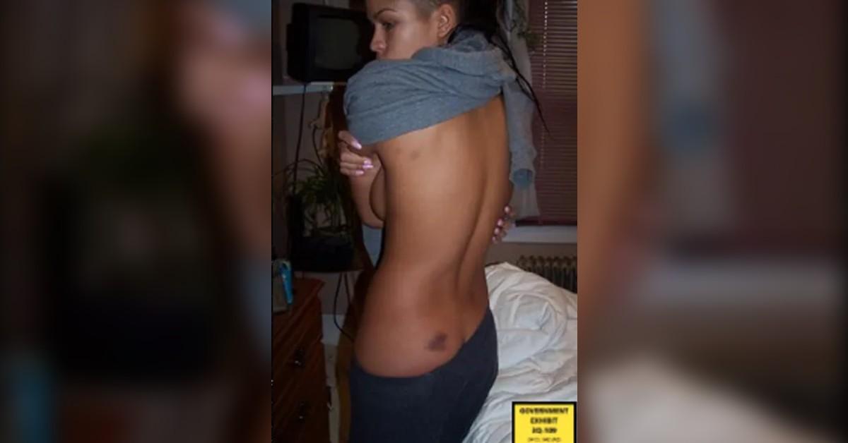 cassie ventura court injury pics