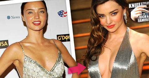 //miranda kerr boob job after orlando bloom split wide