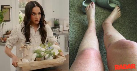 Photo of Meghan Markle, The Burns