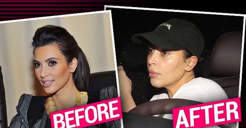 Kim Kardashian Nose Job
