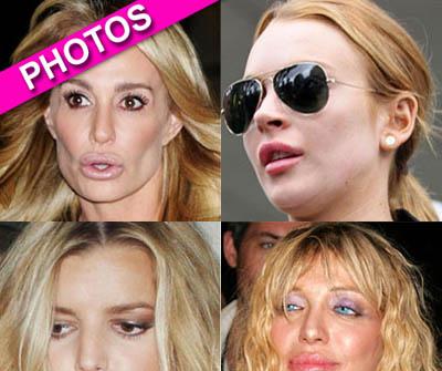 //plastic surgery lipsbfd