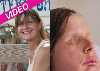 //charlanash splashnews