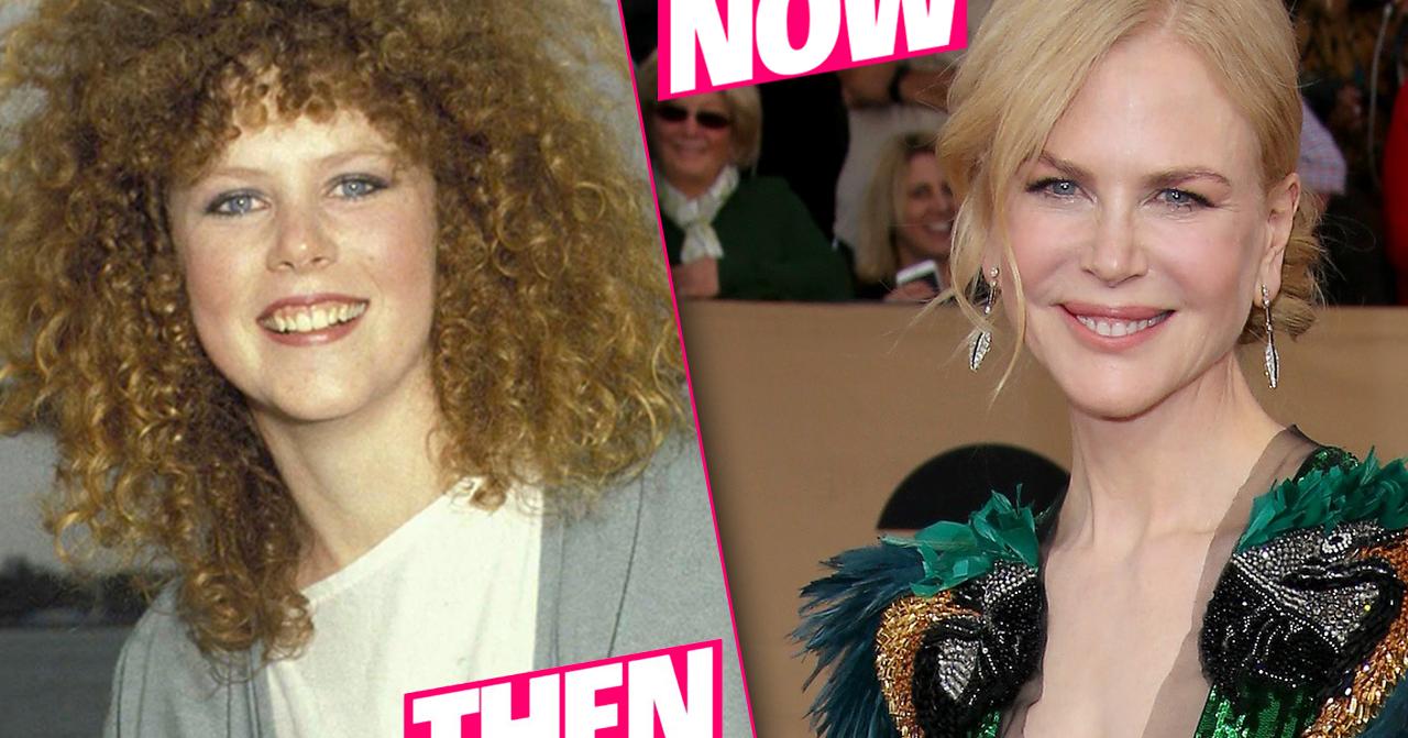 Nicole Kidman Plastic Surgery Photo Details