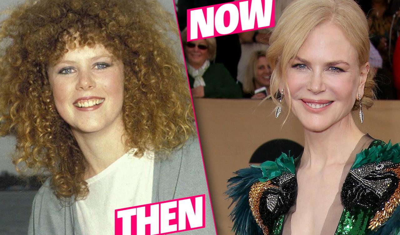 Nicole Kidman Plastic Surgery Photo Details