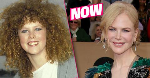 Nicole Kidman Plastic Surgery