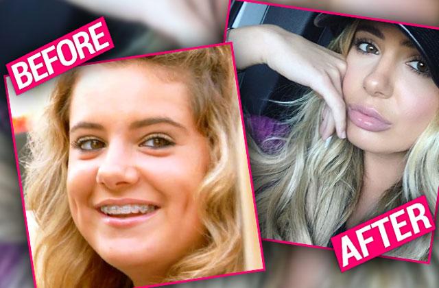 Brielle Biermann Nose Job Plastic Surgery RHOA