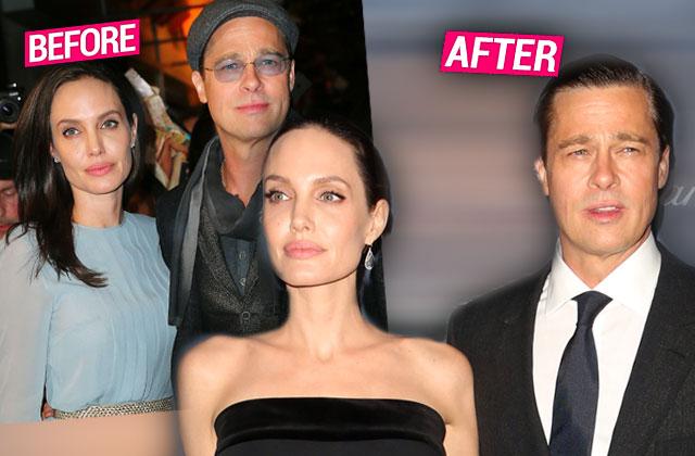 angelina jolie brad pitt plastic surgery botox