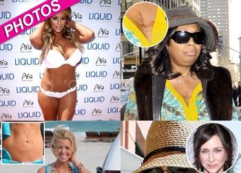 //pp_scarsceleb_sn_inf