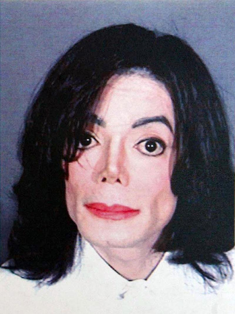 Michael Jackson Doctor Arnold Klein Dead Secrets