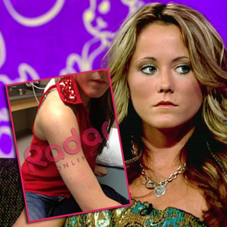 Jenelle Evans’ Bloody Arm: See More Evidence Of Her Attack Claim