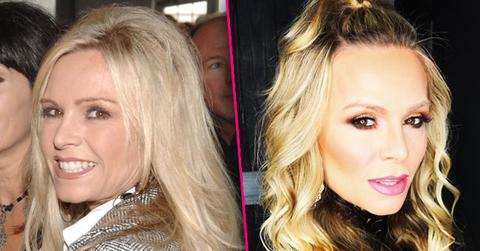 //Tamra Judge Plastic Surgery Fillers Botox Eyelid pp