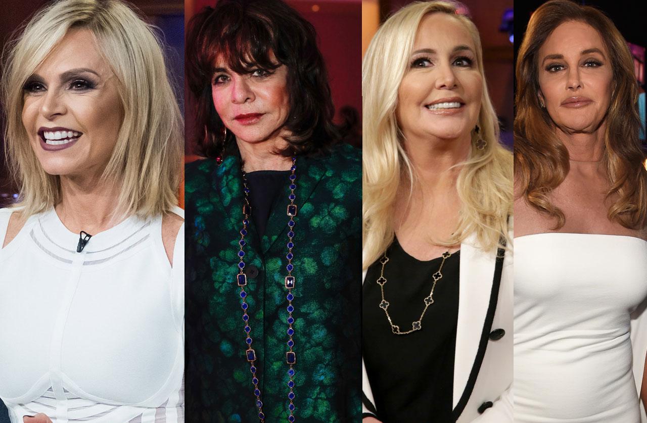 Halloween In Hollywood! Scariest Celeb Plastic Surgery Nightmares of 2017