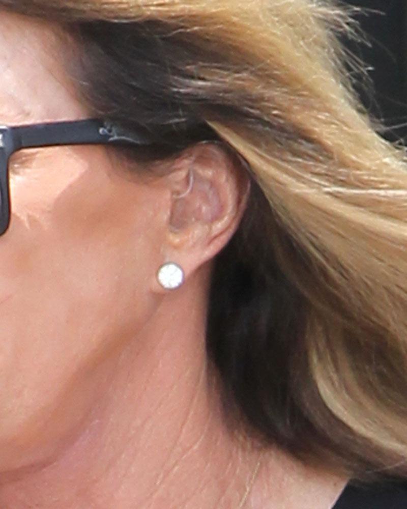 Caitlyn Jenner Hearing Aid Photos