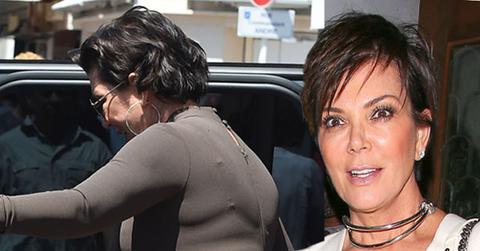//kris jenner plastic surgery pp