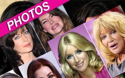 //surgical blunders wenngetty post