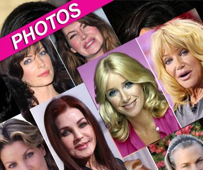 //surgical blunders wenngetty post