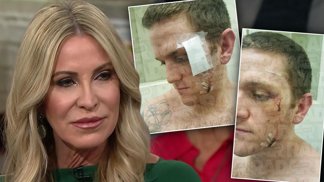 Ex-'RHOC' Star Lauri Peterson's Son Suffers Deep Wounds From Jail Attack