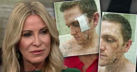 Ex-'RHOC' Star Lauri Peterson's Son Suffers Deep Wounds From Jail Attack