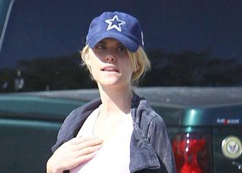 //lauren scruggs reveals prosthetic eye fameflynet