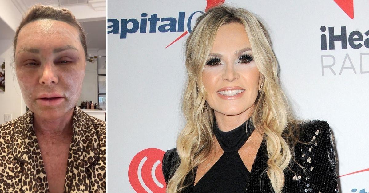 'RHOC' Star Tamra Judge Goes Public With Mom's Brutal Takedown of Her $15K Cosmetic Surgery Spend: 'Your Face Makes Me Want to Throw Up!'