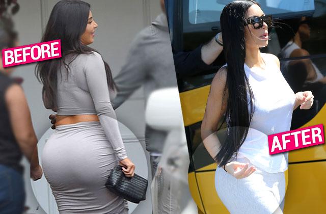 Kim Kardashian Butt Implants Removed Claim Top Plastic Surgeons 4145