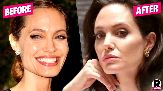 Facelift For Angie Top Doc Claims Surgeon Gave Jolie Her Tight New Look Telltale Photos