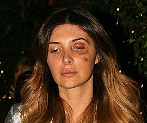 //brittny gastneau tall