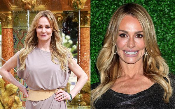 Real Housewives Plastic Surgery Secrets REVEALED 18 Stars Who ve