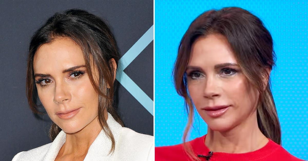 victoria beckham new face lips shock plastic surgeons r