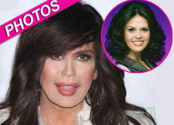 //marie osmond plastic surgery splash getty