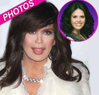 Plastic Fantastic? Marie Osmond Has ‘Undergone A Startling