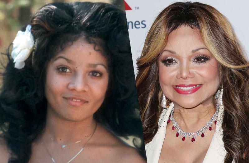 celebrity plastic surgery freaky faces