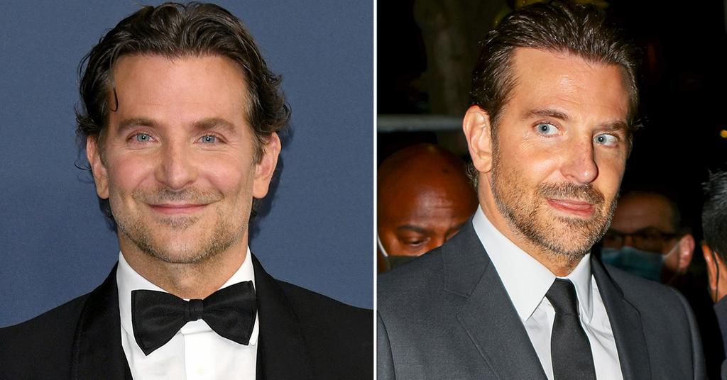 Bradley Cooper S Shocking New Face Plastic Surgeons Weigh In   Bradleycooper 1646164104433 