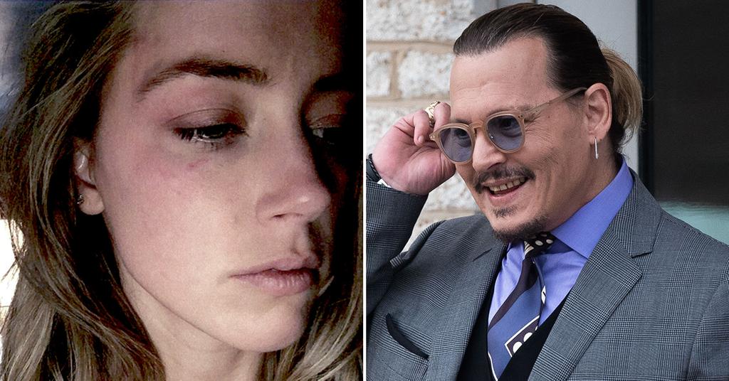 Johnny Depp Chuckles As Amber Heards Bruised Face Is Shown To Jury 