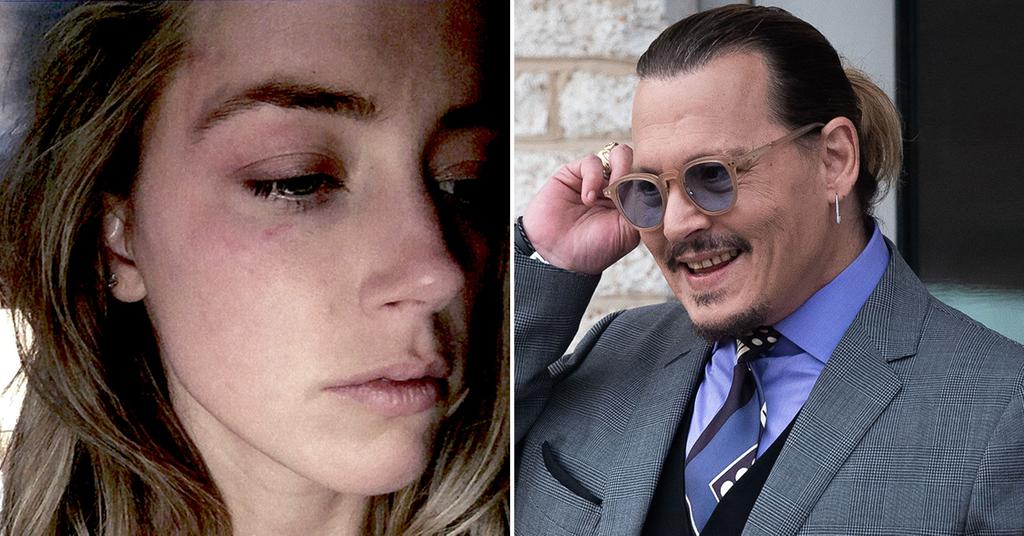 Johnny Depp Chuckles As Amber Heard's Bruised Face Is Shown To Jury