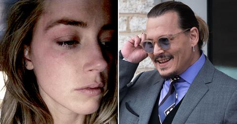 johnny depp laughs amber heard bruised face photos raquel pennington