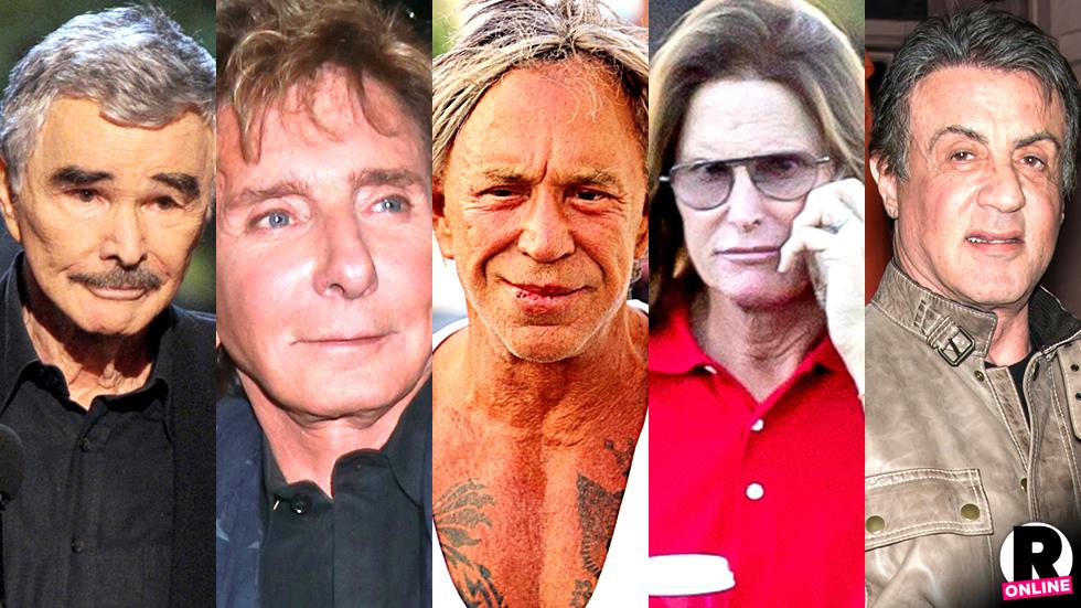 Male Plastic Surgery Disasters! 10 Photos Of Bruce Jenner, Sylvester