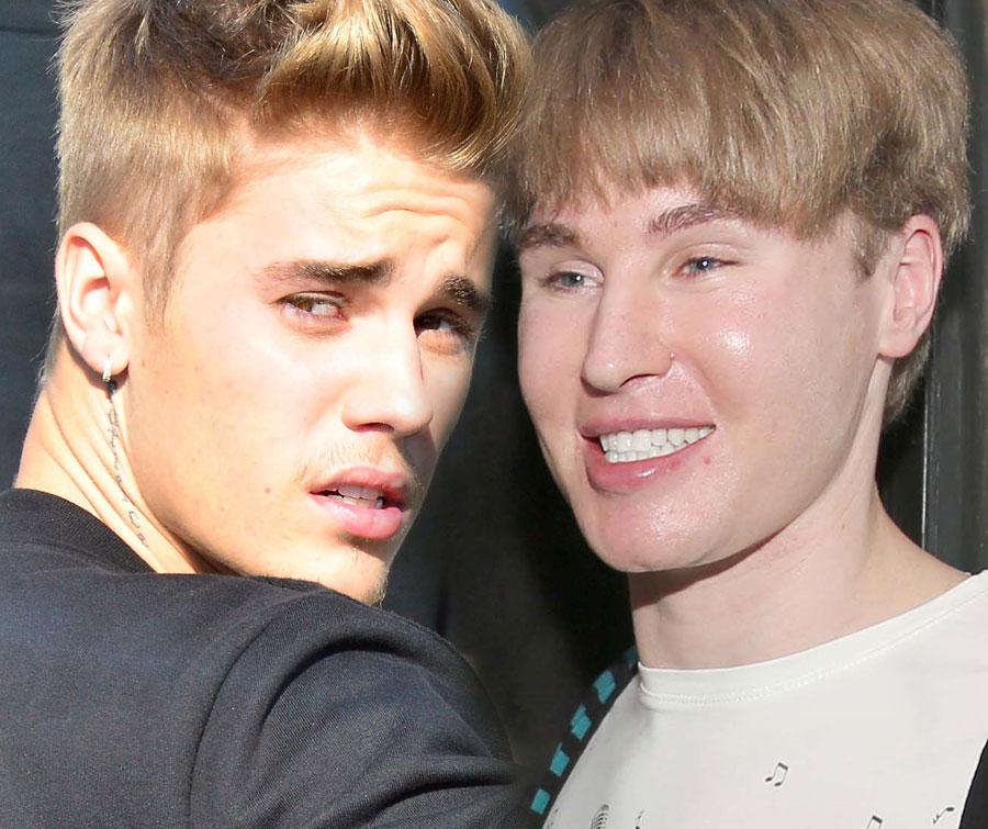 Celebrity Obsessed! 15 Extreme Fans Who Had Plastic Surgery To Look ...