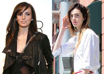 //ali lohan botox
