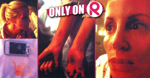 //camille grammer injuries